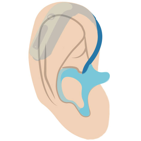 Hinter-dem-Ohr-Hörgerät - So wird es getragen