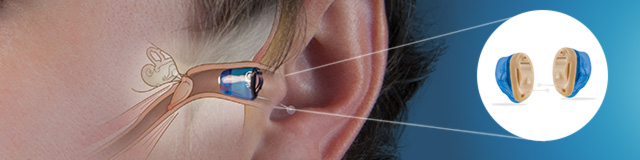 Smarte Im-OhrHörgeräte
